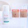 Avène Cleanance Comedomed+ Concentrado Anti-Imperfeições 30ml