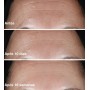 Clinique Smart Clinical Repair Wrinkle Correcting Serum 30ml