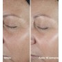 Clinique Smart Clinical Repair Wrinkle Correcting Serum 30ml
