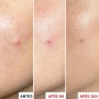 Erborian Centella SOS Patch Gel 9ml