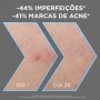 Garnier Pure Active Sérum Anti Imperfeições 30ml 