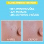 Garnier Skin Active BHA+Niacinamida Fluido Anti-imperfeições Mate 40ml