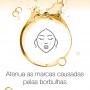 Neutrogena Spot Controlling Hidratante Facial Oil Free 50ml